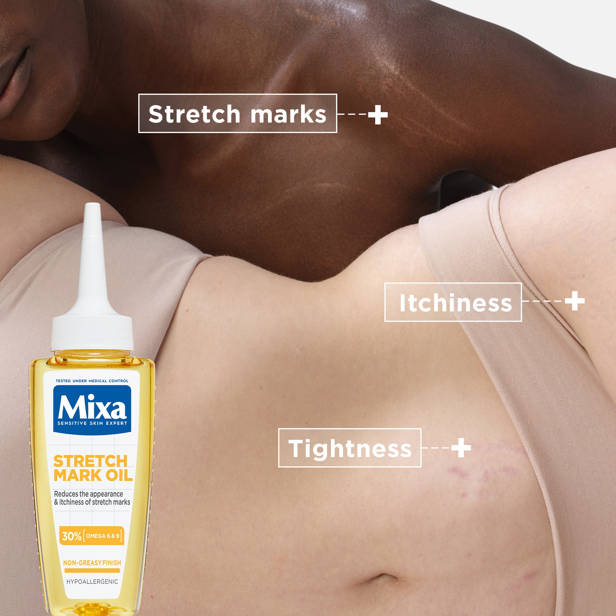 Niacinamide Stretch Mark Oil 100ml