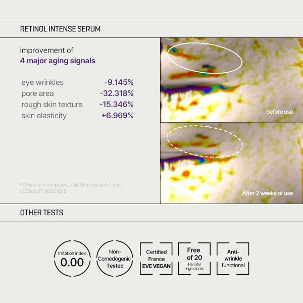 Retinol Intense Trial Kit - Benefits