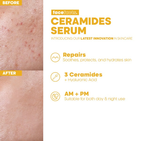 Face Facts Barrier Repair Ceramide Facial Serum